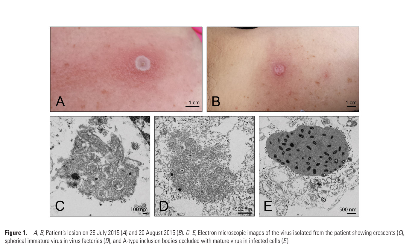 Alaskapox case reported in Alaska, what to know about virus Alaskapox