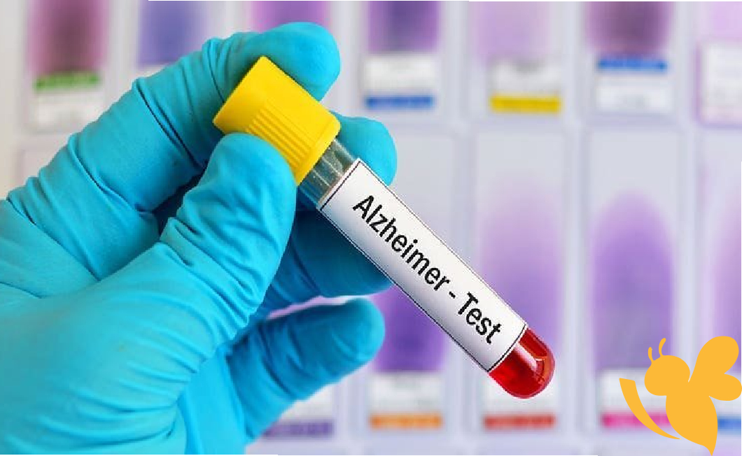 FDA Authorizes New Blood Test to Detect Alzheimer’s Disease